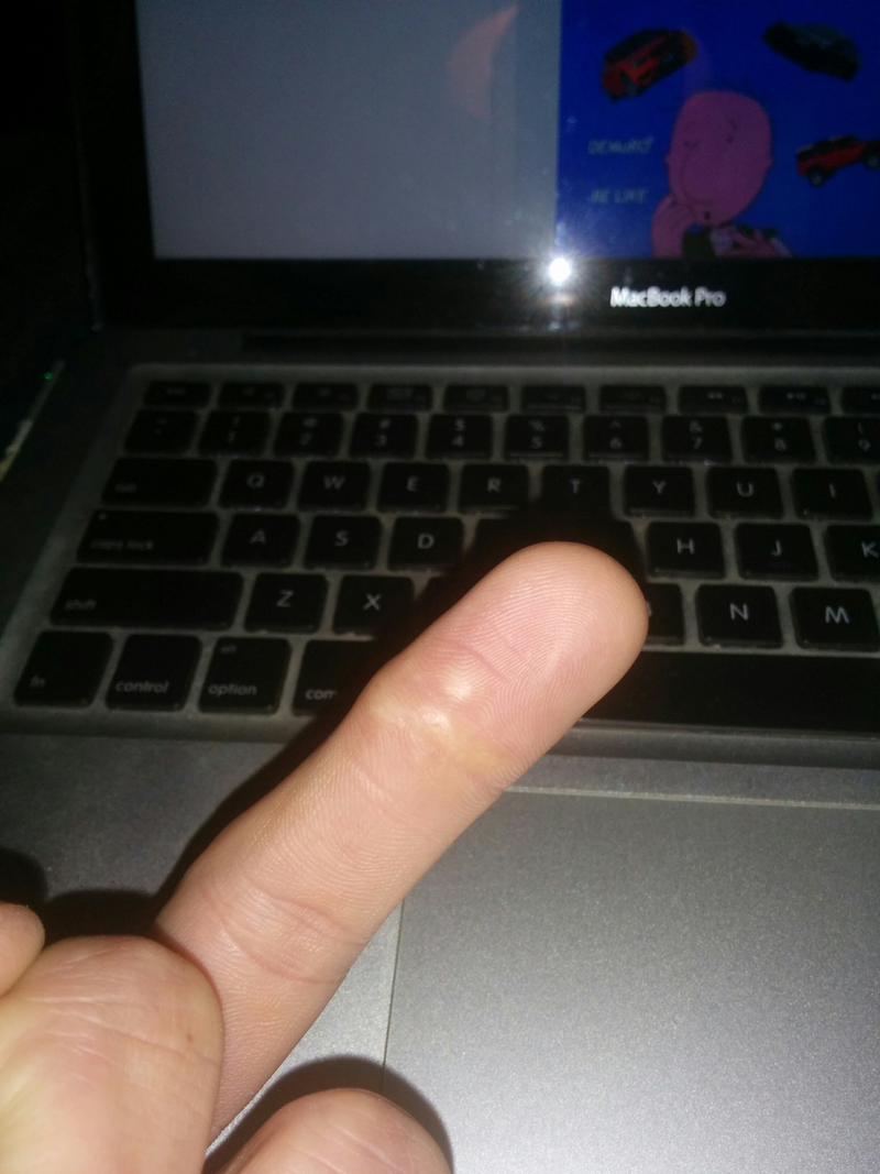 Illustration for article titled I'm a self conscious idiot because of these three fingers